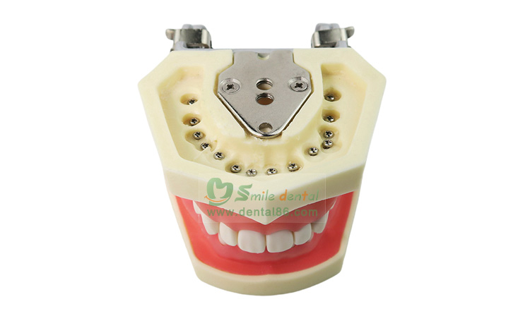 TM-A14 Standard Model